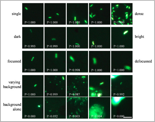 Publication: Machine-assisted interpretation of auramine stains Publication: Machine-assisted interpretation of auramine stains