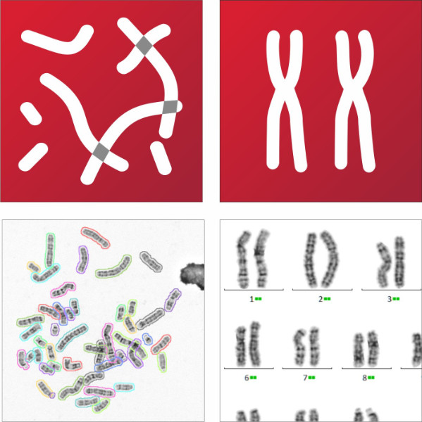 MetaSystems Announces Grant of US Patent for AI based Chromosome Analysis