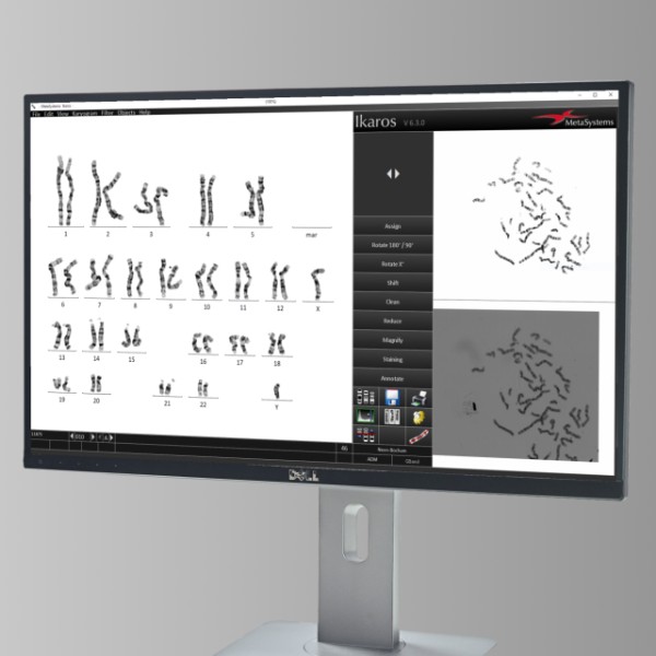 Collaboration with MLL on AI-based Karyotyping